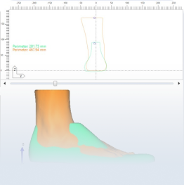 DISEÑO

Con todos los datos de tus pies capturados en la evaluación, el equipo de diseño utiliza un software para diseñar tus zapatos con las medidas y ajustes necesarios para tus pies.